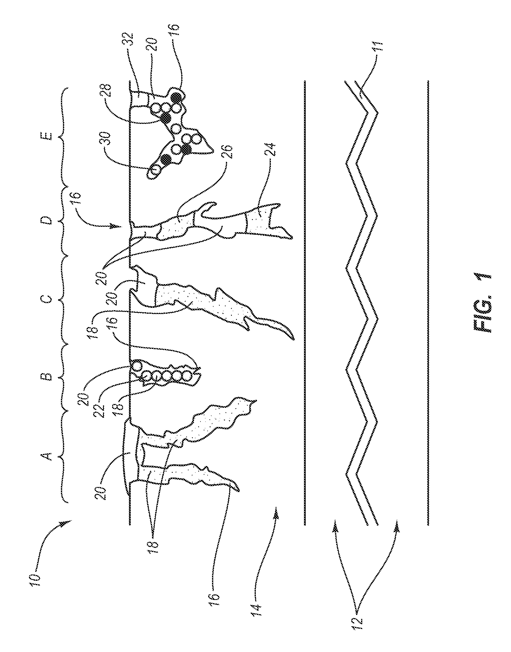 Methods of using medical devices for controlled drug release