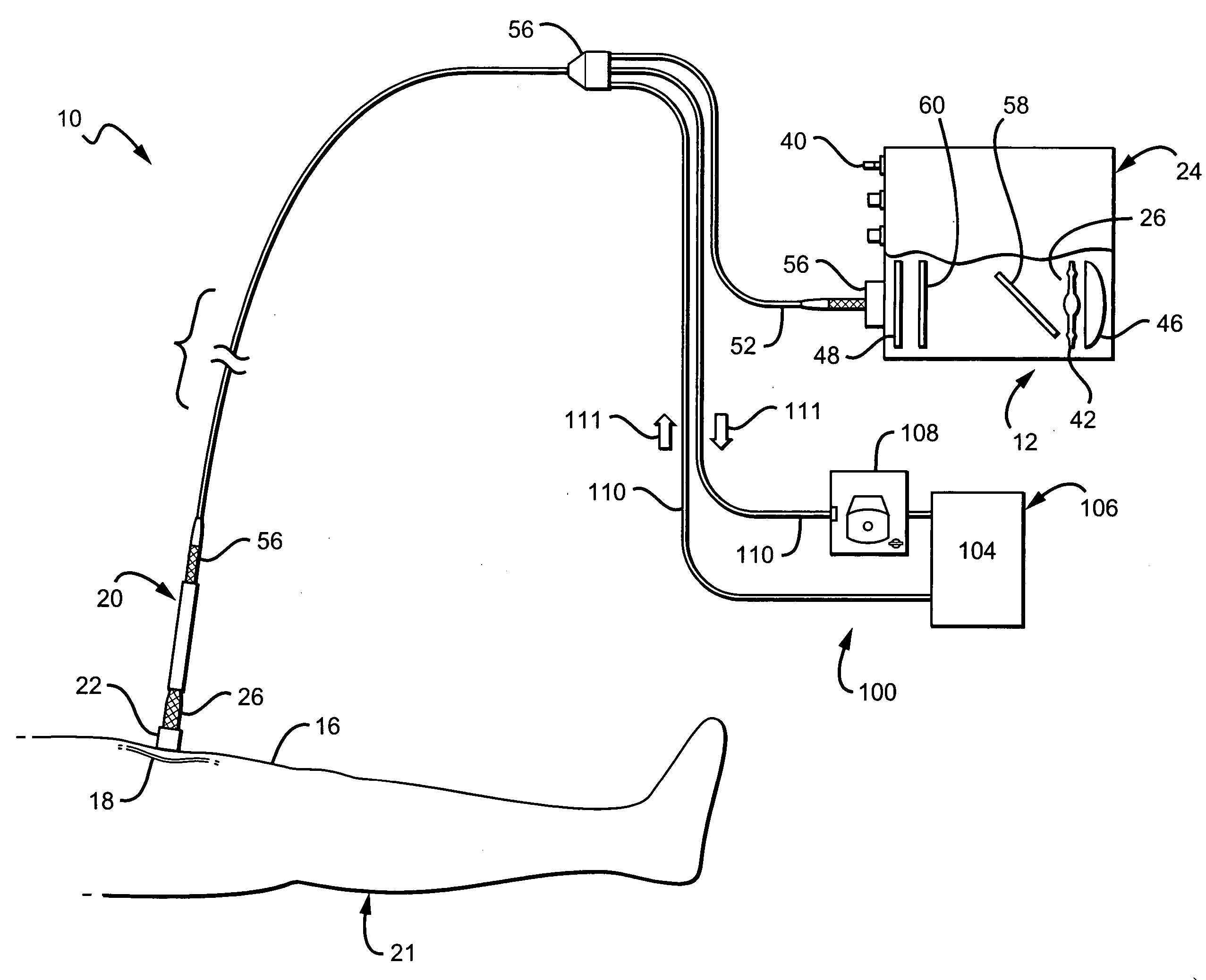 Vascular occlusion systems and methods
