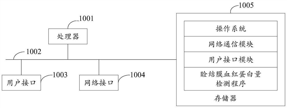 Eyelid conjunctiva hemoglobin amount detection method, device and equipment and storage medium