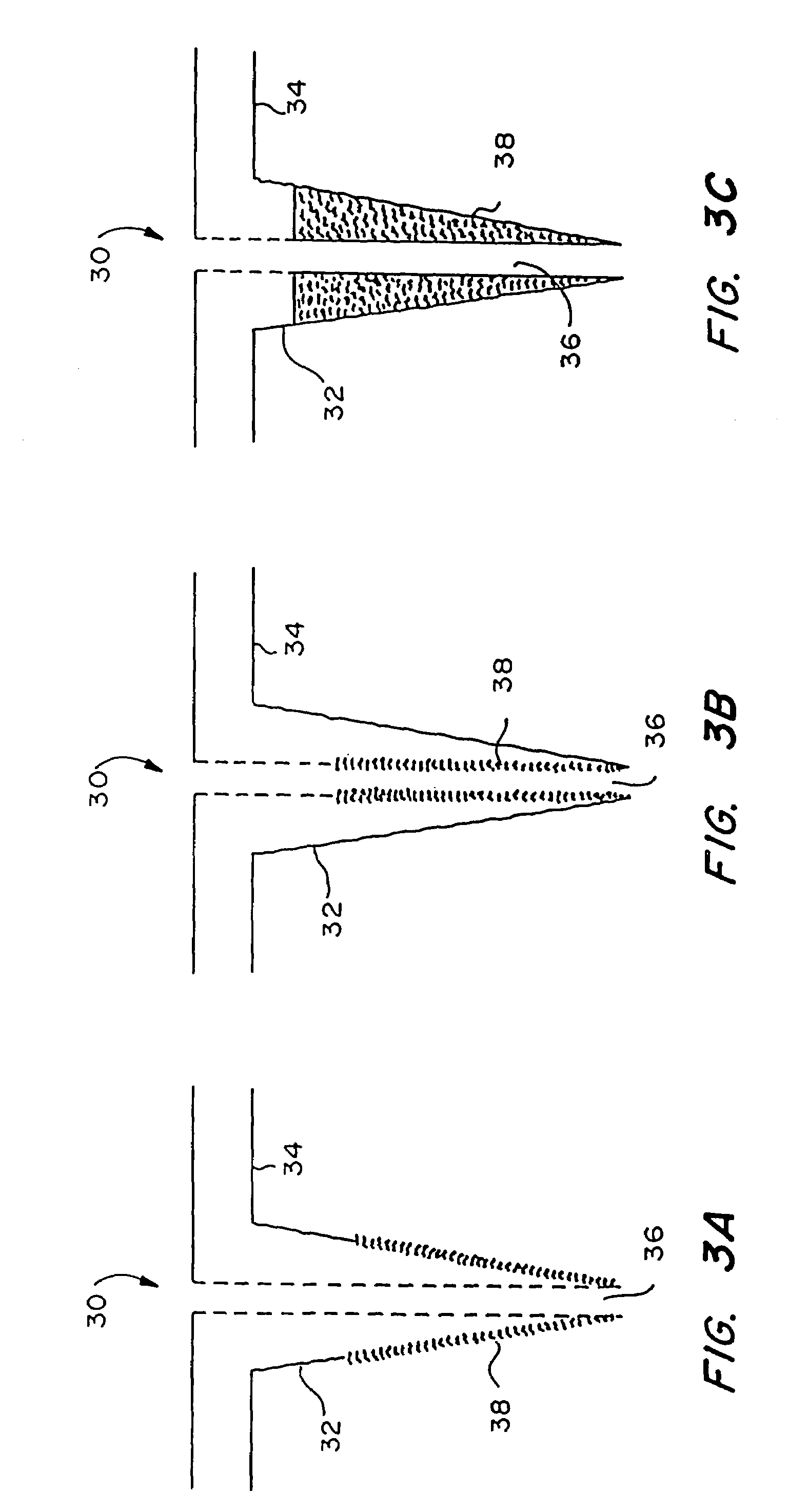 Microneedle device for extraction and sensing of bodily fluids