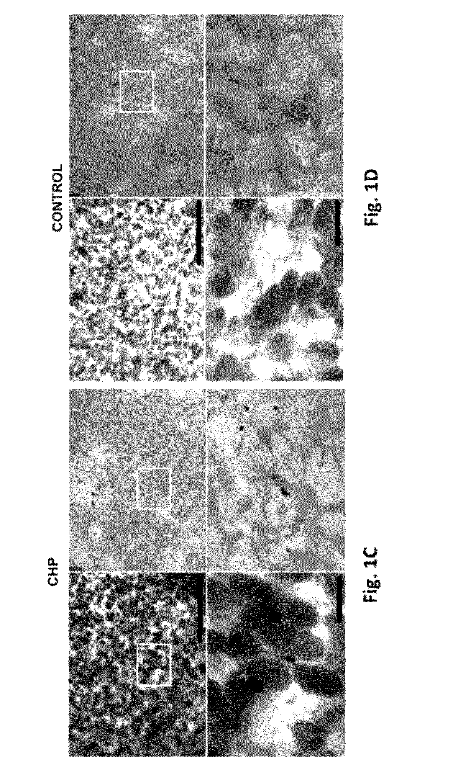 Carcinoma Homing Peptide (CHP), Its Analogs, and Methods of Using
