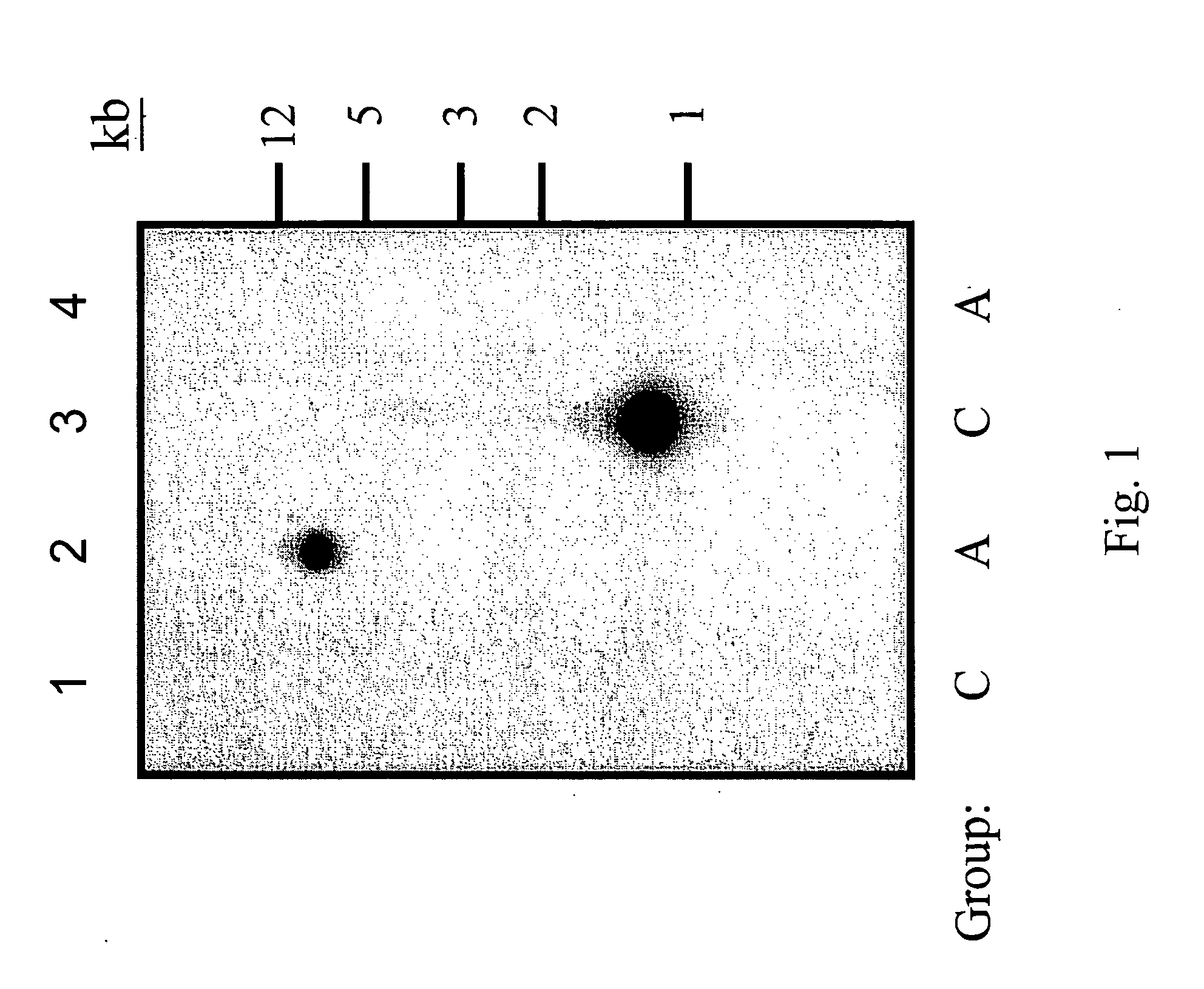 Methods of producing hyaluronic acid using a recombinant hyaluronan synthase gene