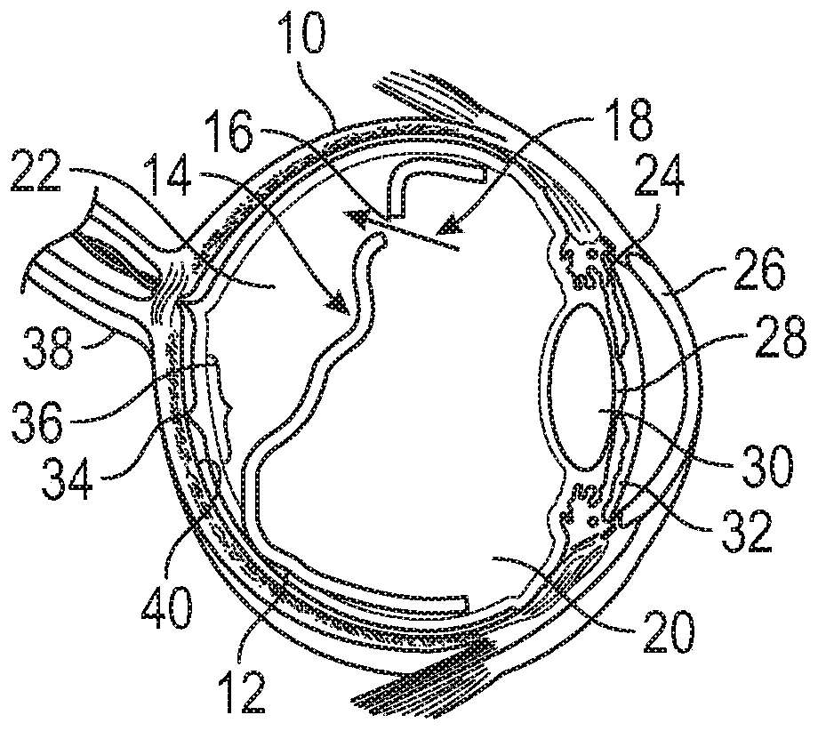 Methods and devices for treating a retinal detachment