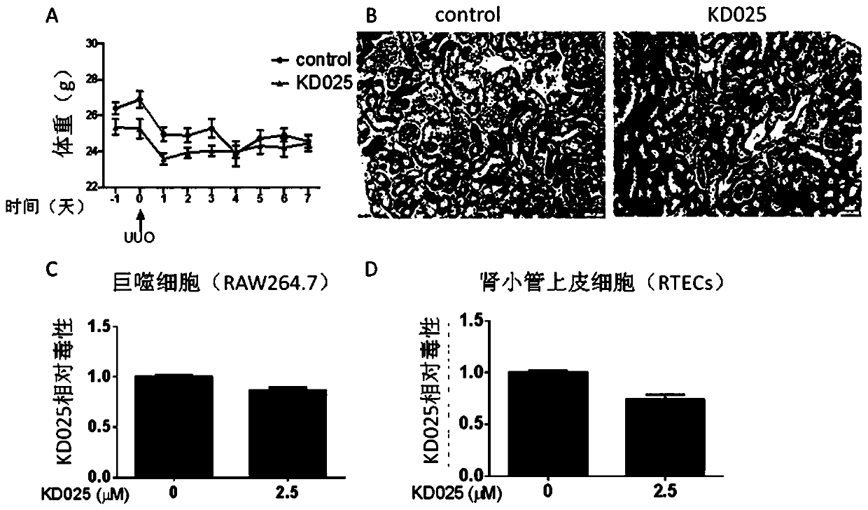 Application of KD025 in preparation of drugs for preventing and treating chronic renal fibrosis