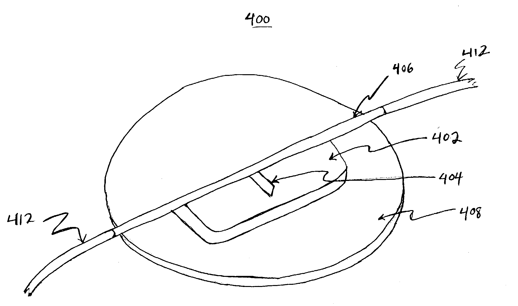 Systems and methods for flow detection and measurement in CSF shunts
