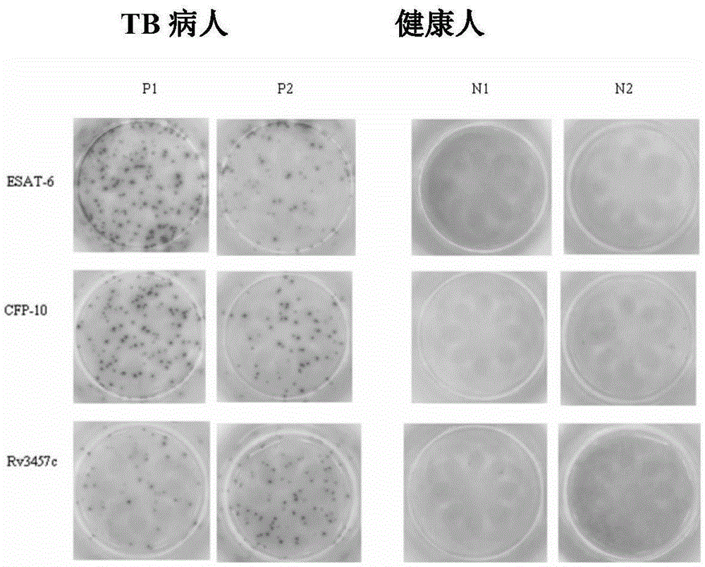 Mycobacterium tuberculosis Rv3457c recombinant protein as well as preparation method and application thereof