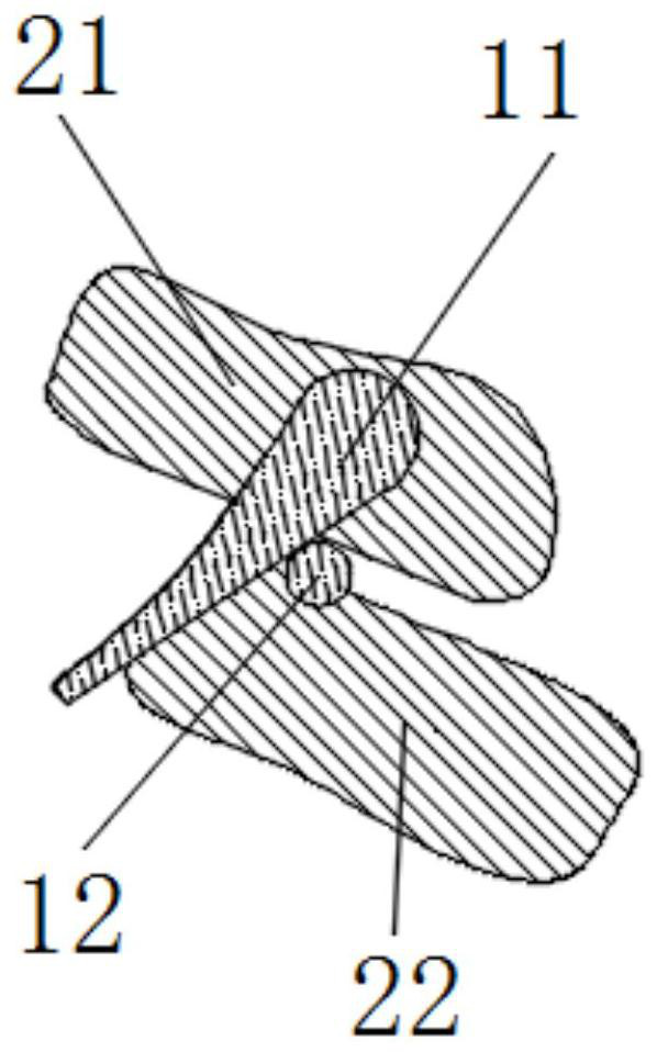 Forward mandibular positioning device for orthodontics