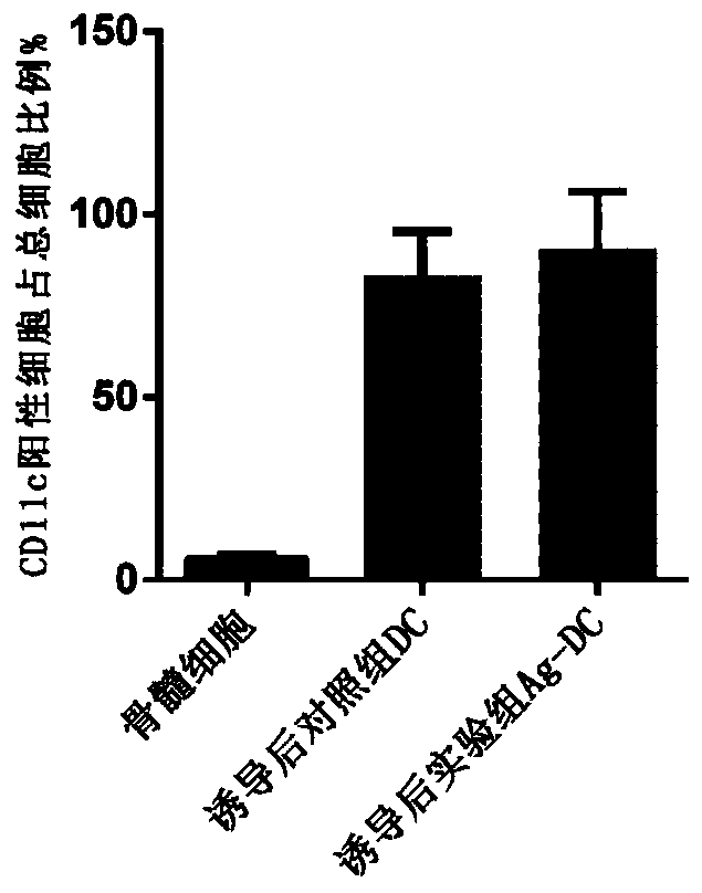 Composition of DC vaccine and NKG2A antagonist and application of composition in anti-breast cancer or liver cancer