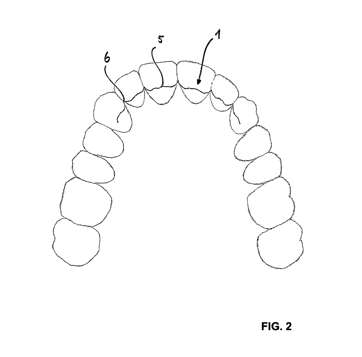 Retainer and method for production thereof
