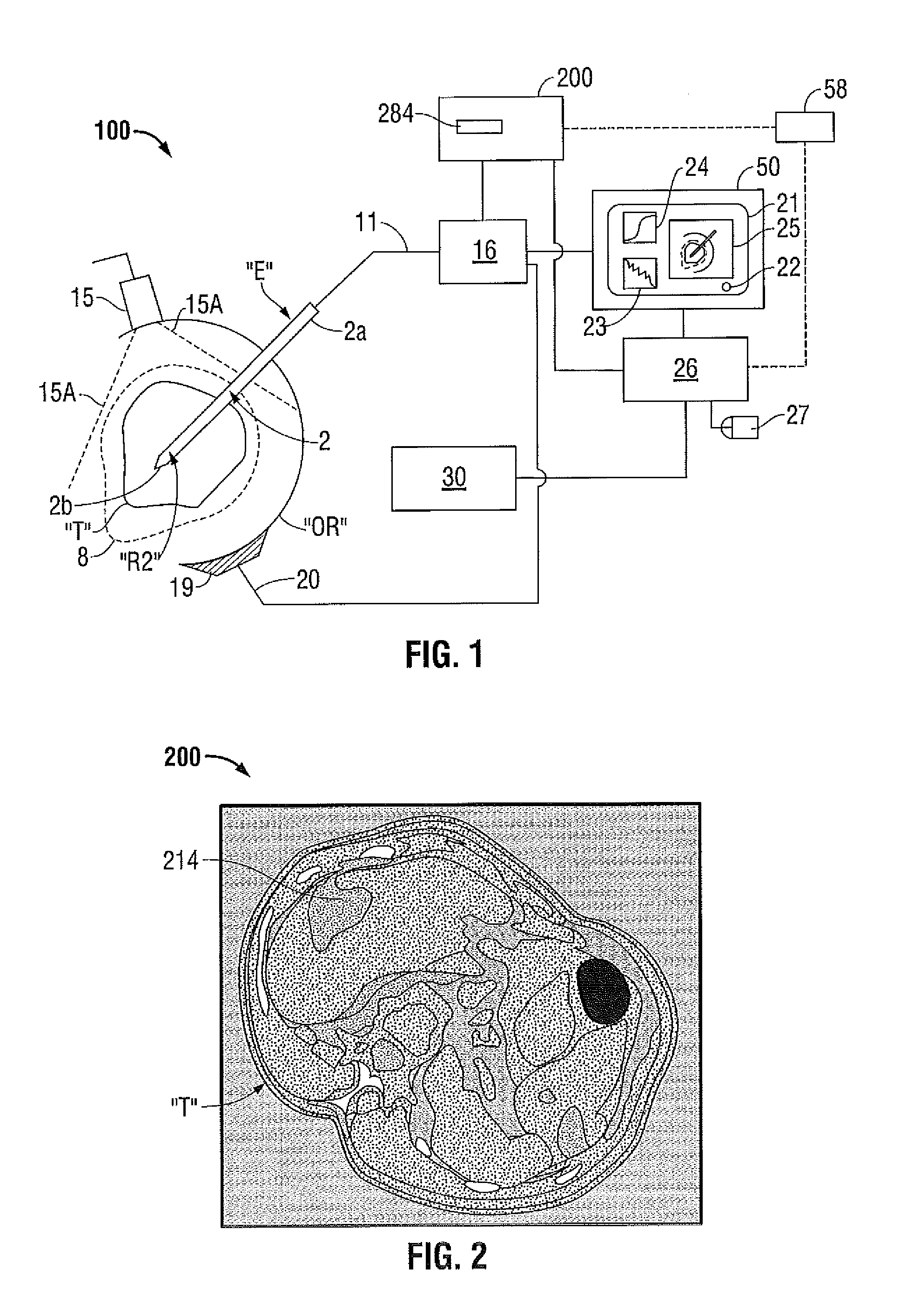 Methods for Image Analysis and Visualization of Medical Image Data Suitable for Use in Assessing Tissue Ablation and Systems and Methods for Controlling Tissue Ablation Using Same