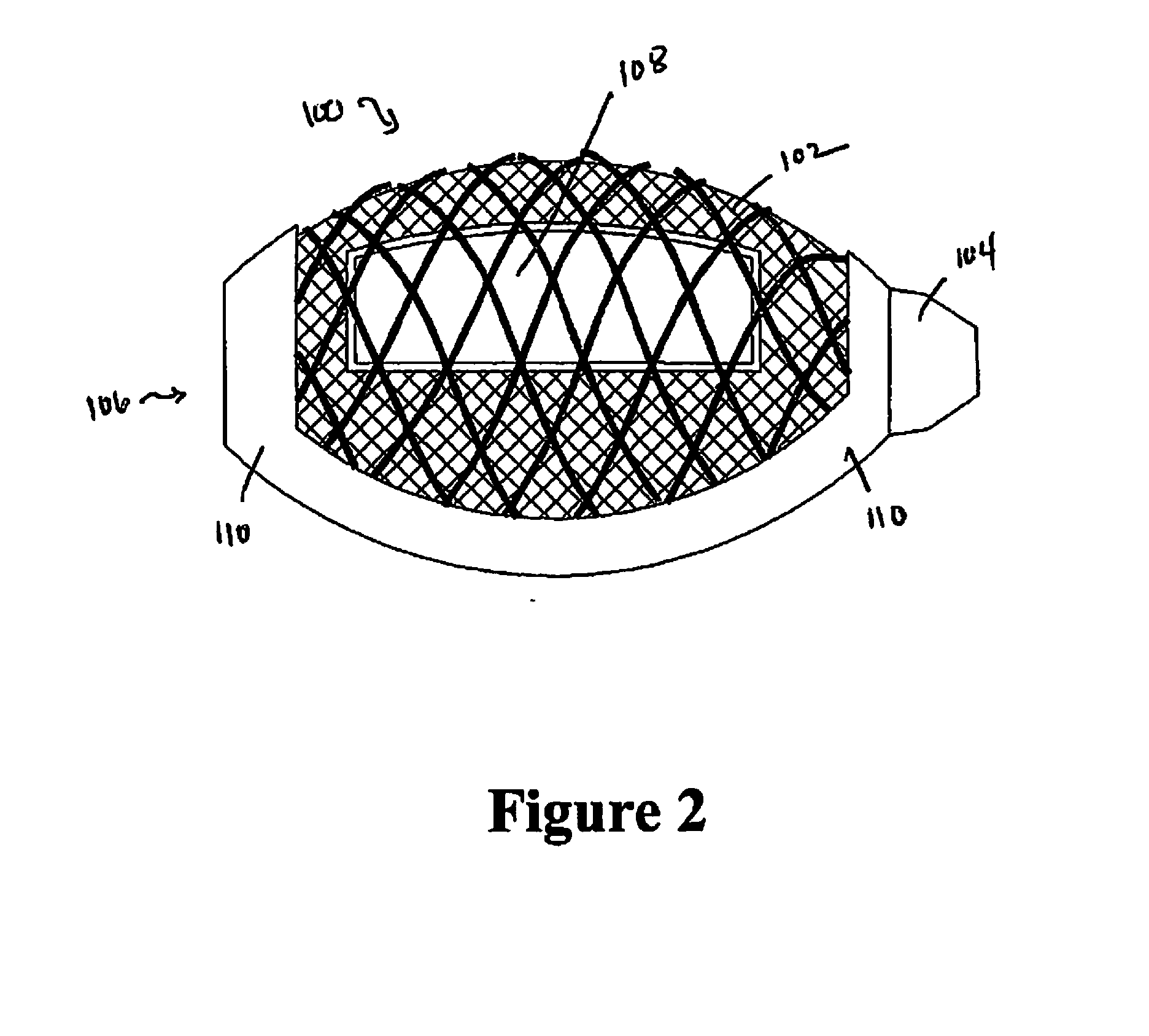 Cement-directing orthopedic implants