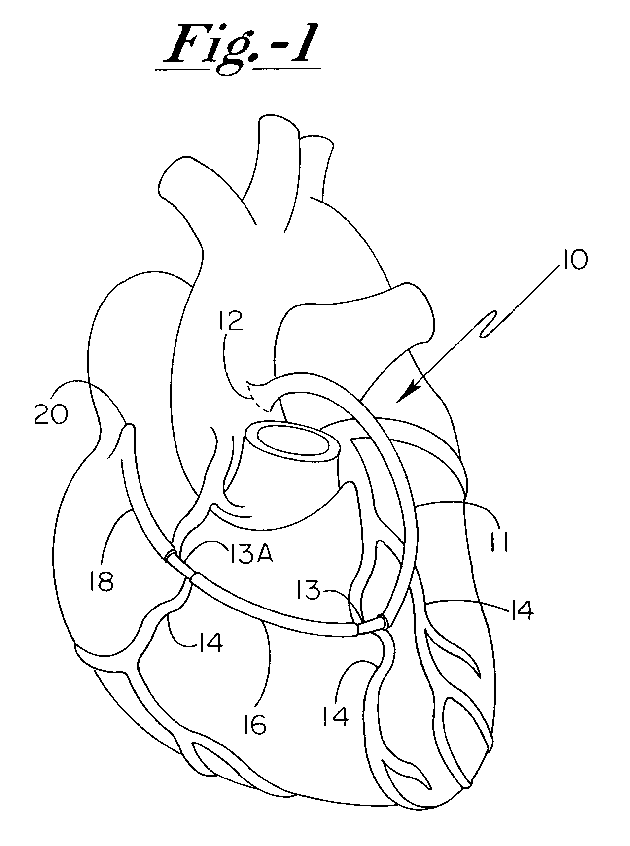 Grafted network incorporating a multiple channel fluid flow connector