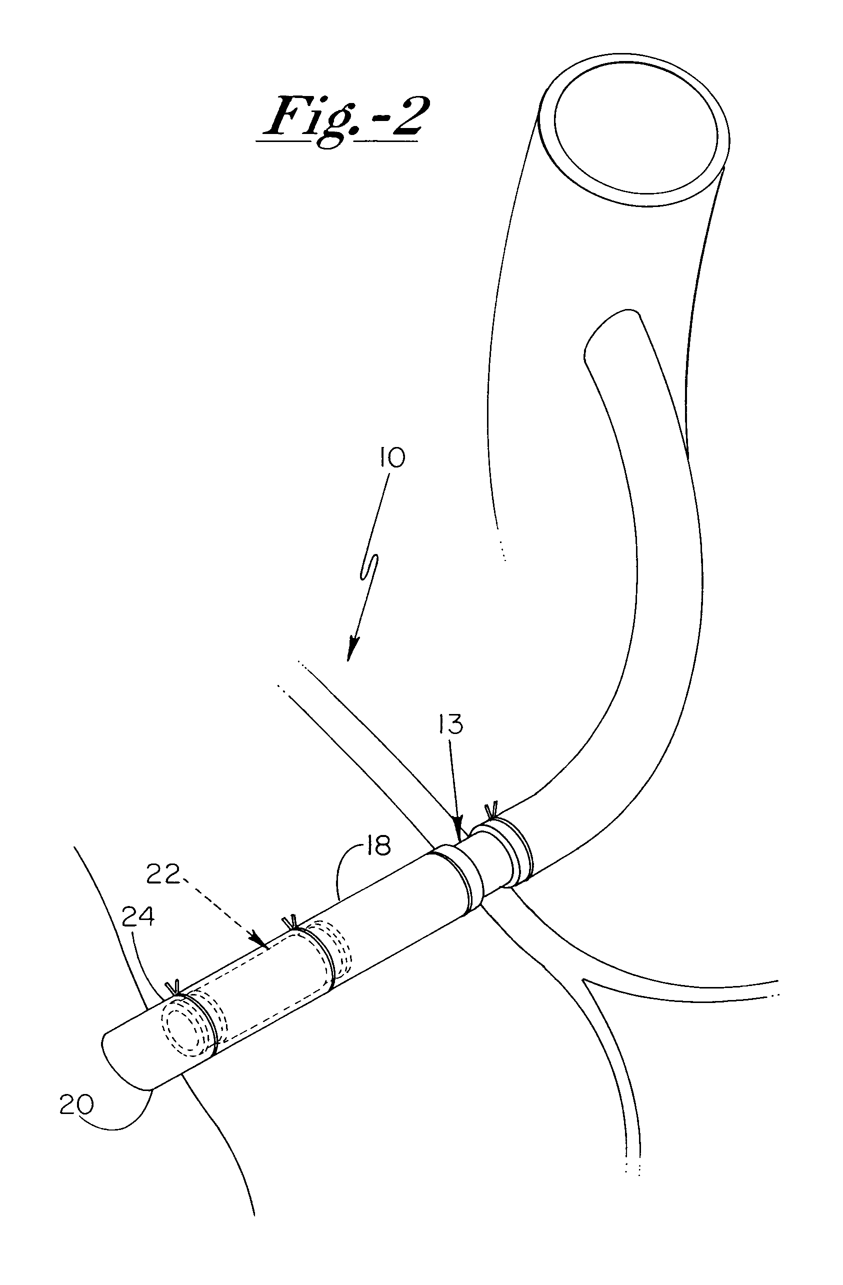 Grafted network incorporating a multiple channel fluid flow connector