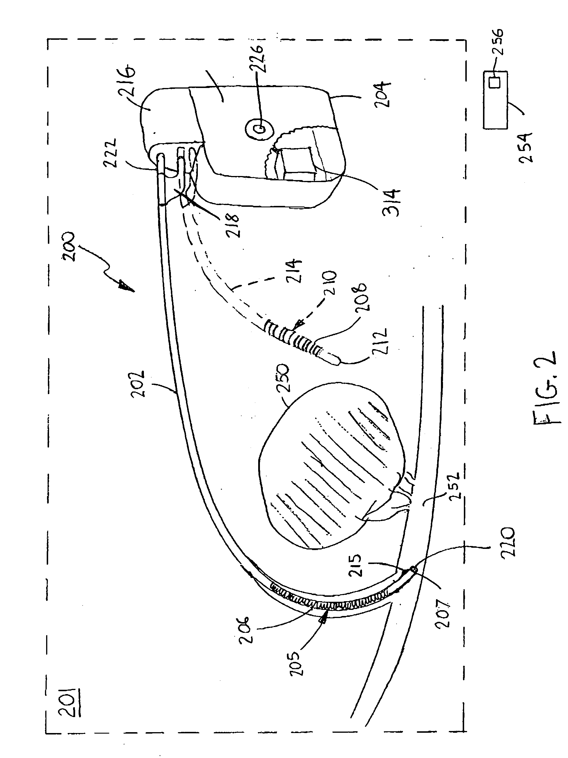 Implantable electroporation therapy device and method for using same
