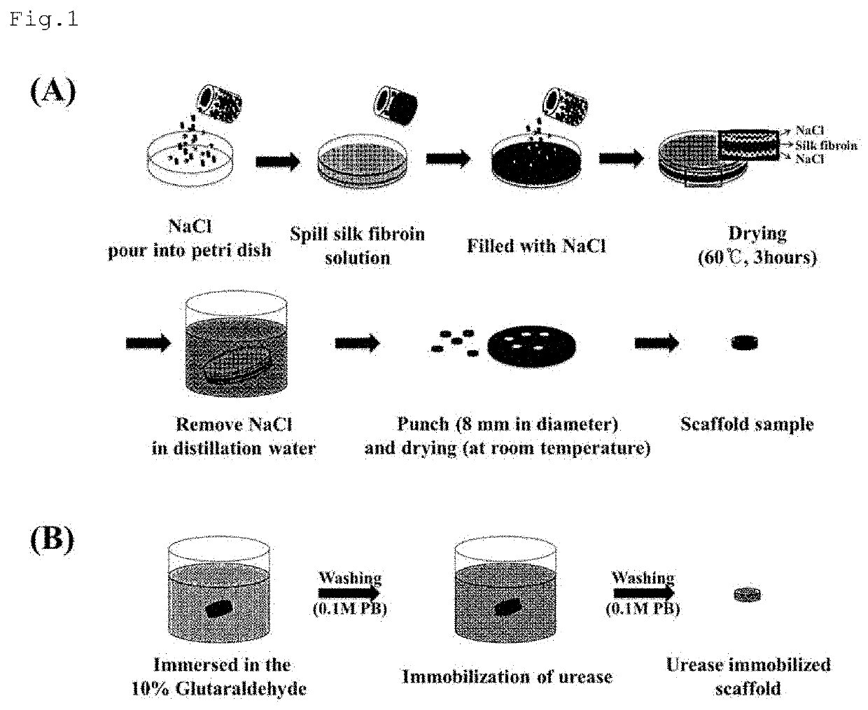 Portable urea sensor using urease-immobilized insoluble porous support