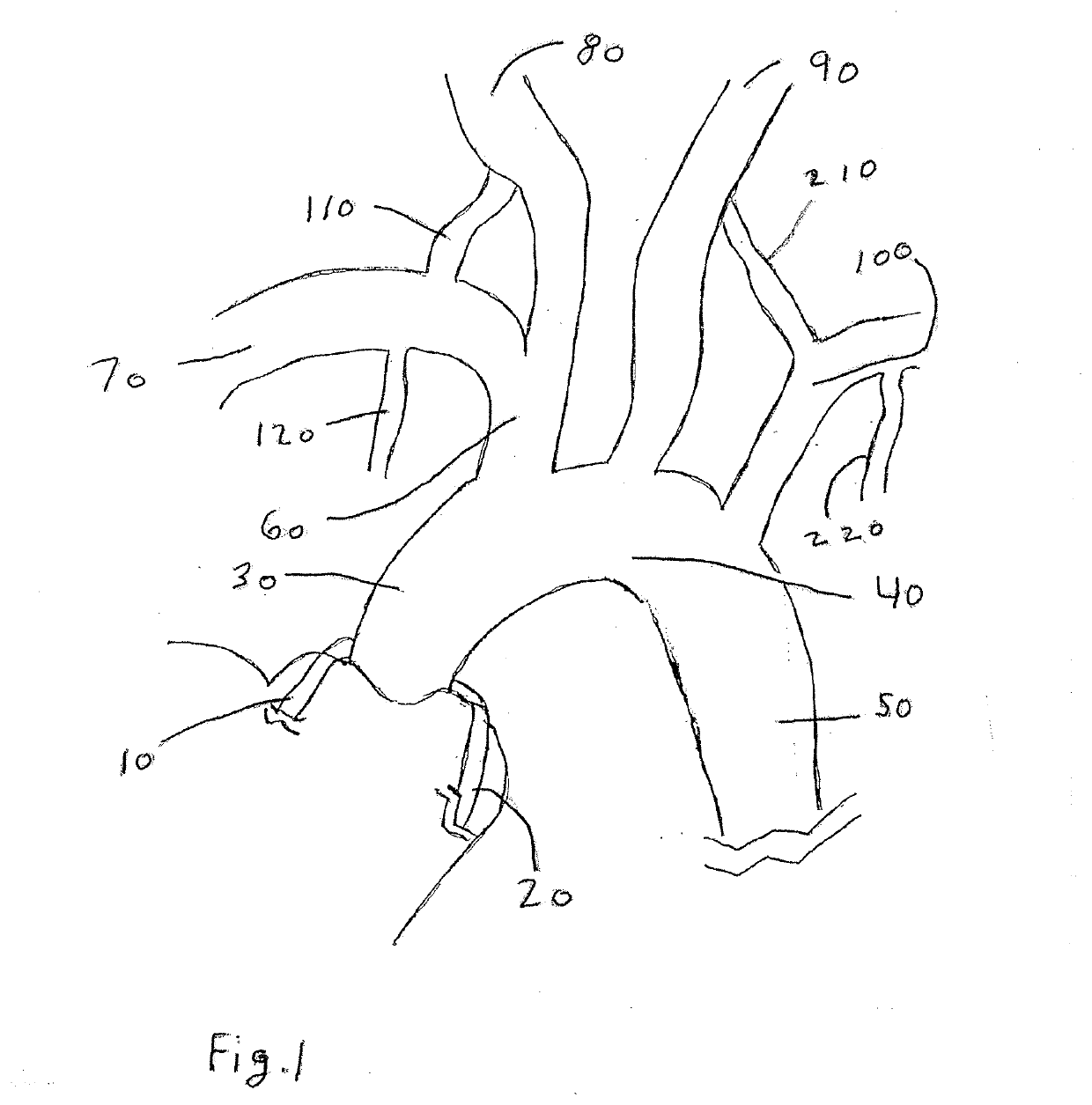 Trans-radial access endovascular catheter