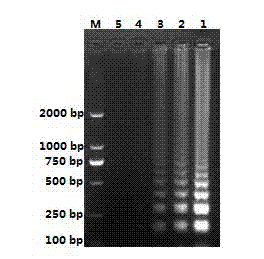 Visualized loop-mediated isothermal amplification kit for detecting Haemophilus parasuis