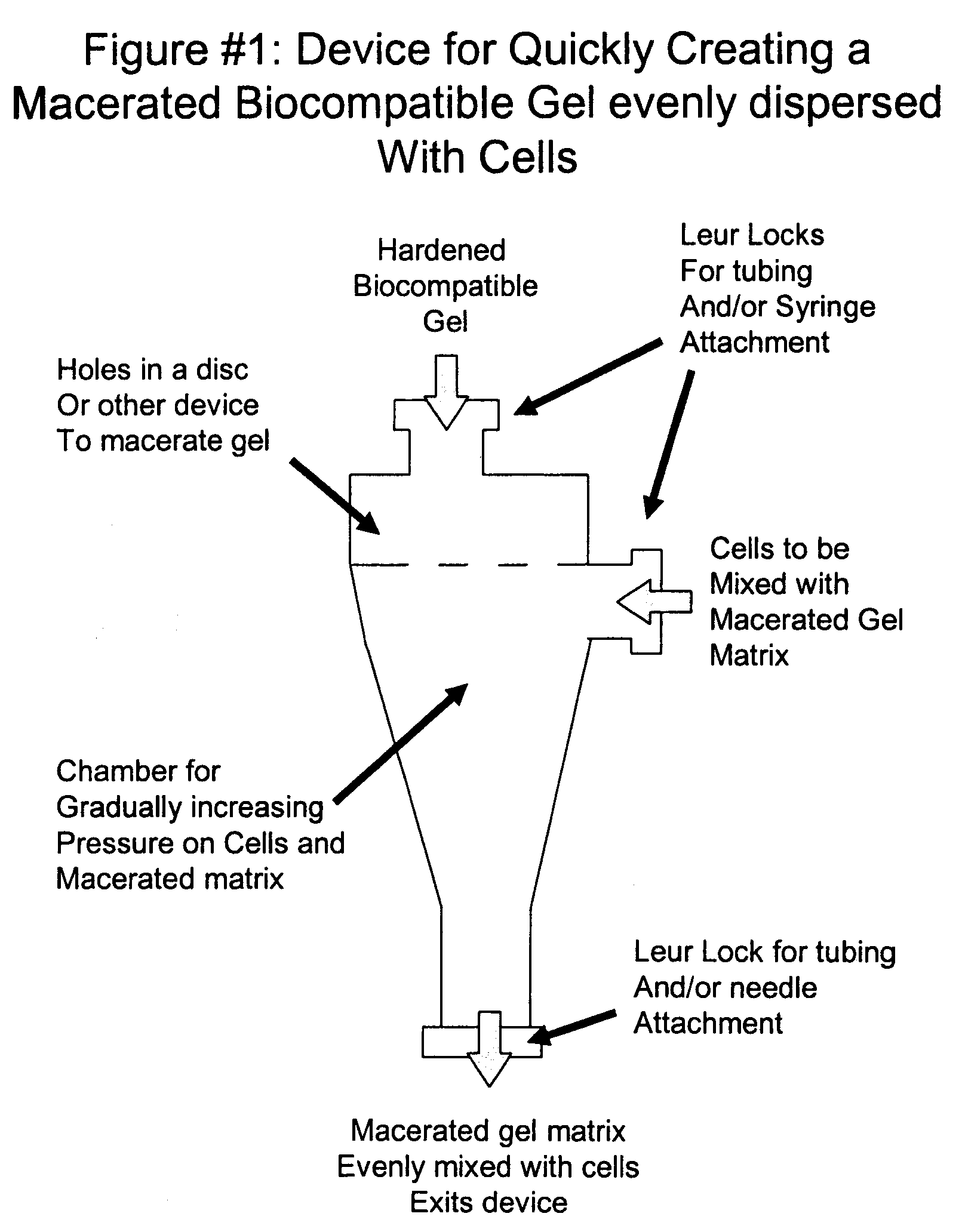 Mesenchymal stem cell isolation and transplantation method and system to be used in a clinical setting