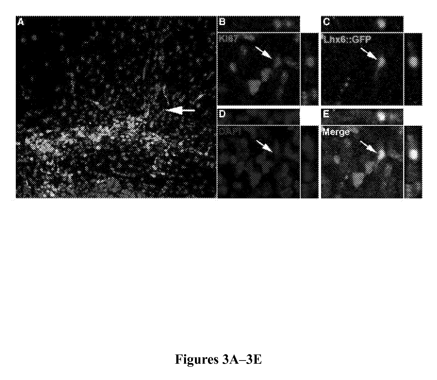 Method to isolate, identify, and use embryonic stem cells directed to forebrain interneuron fate