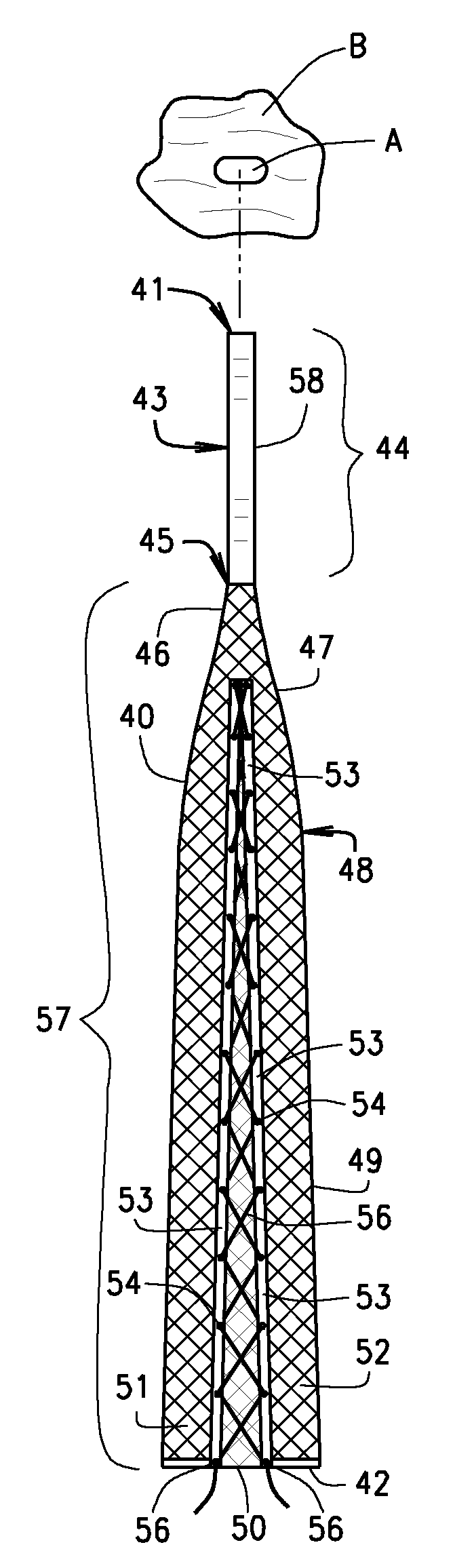 Terminal tissue attachment and repair device