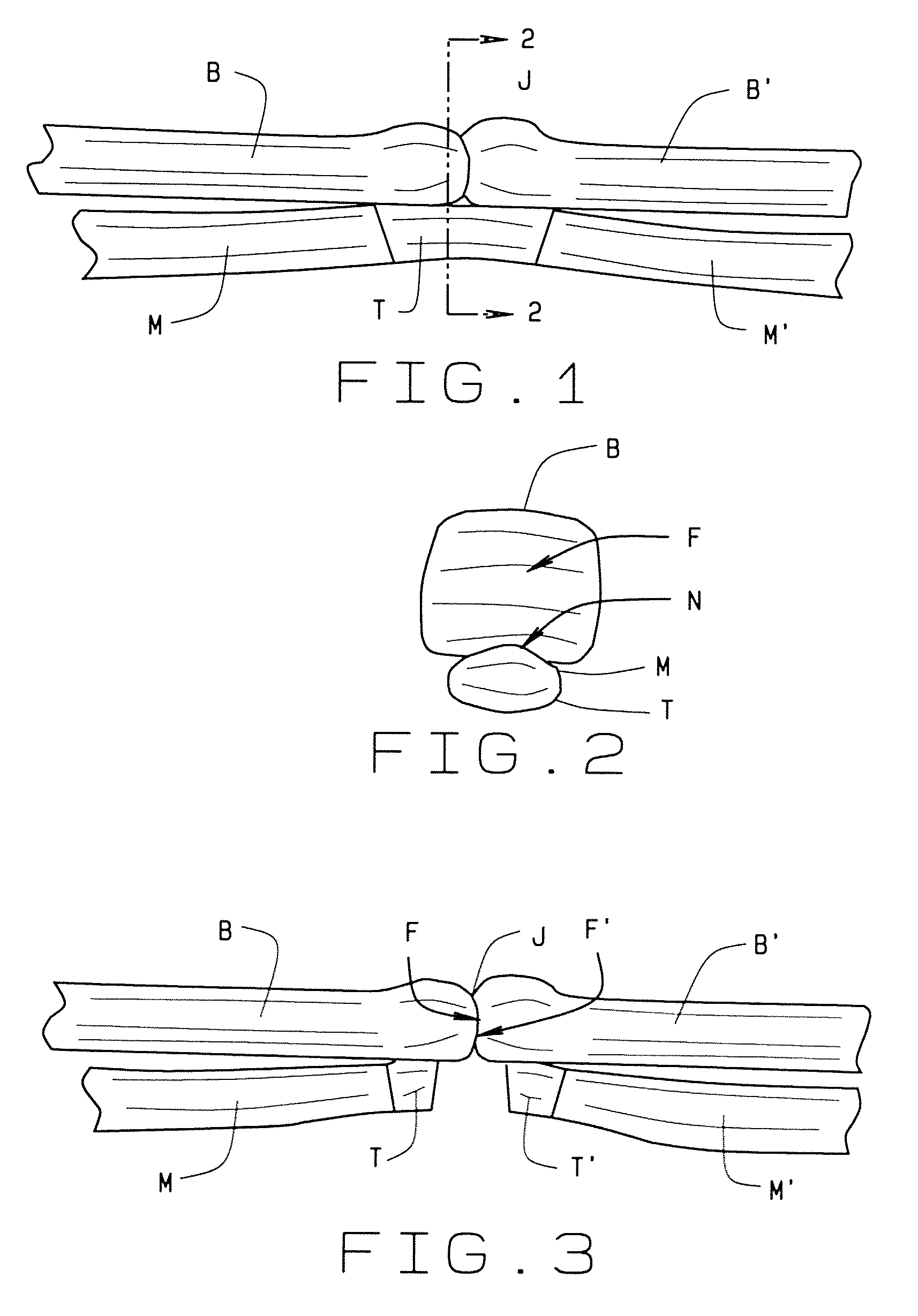 Terminal tissue attachment and repair device