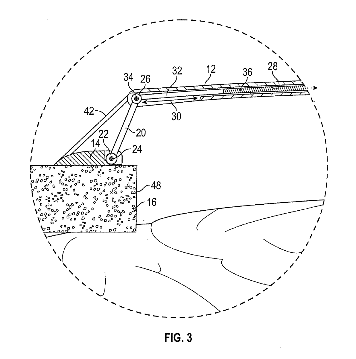 Cranioplasty Plate Assembly with Pivotal Struts