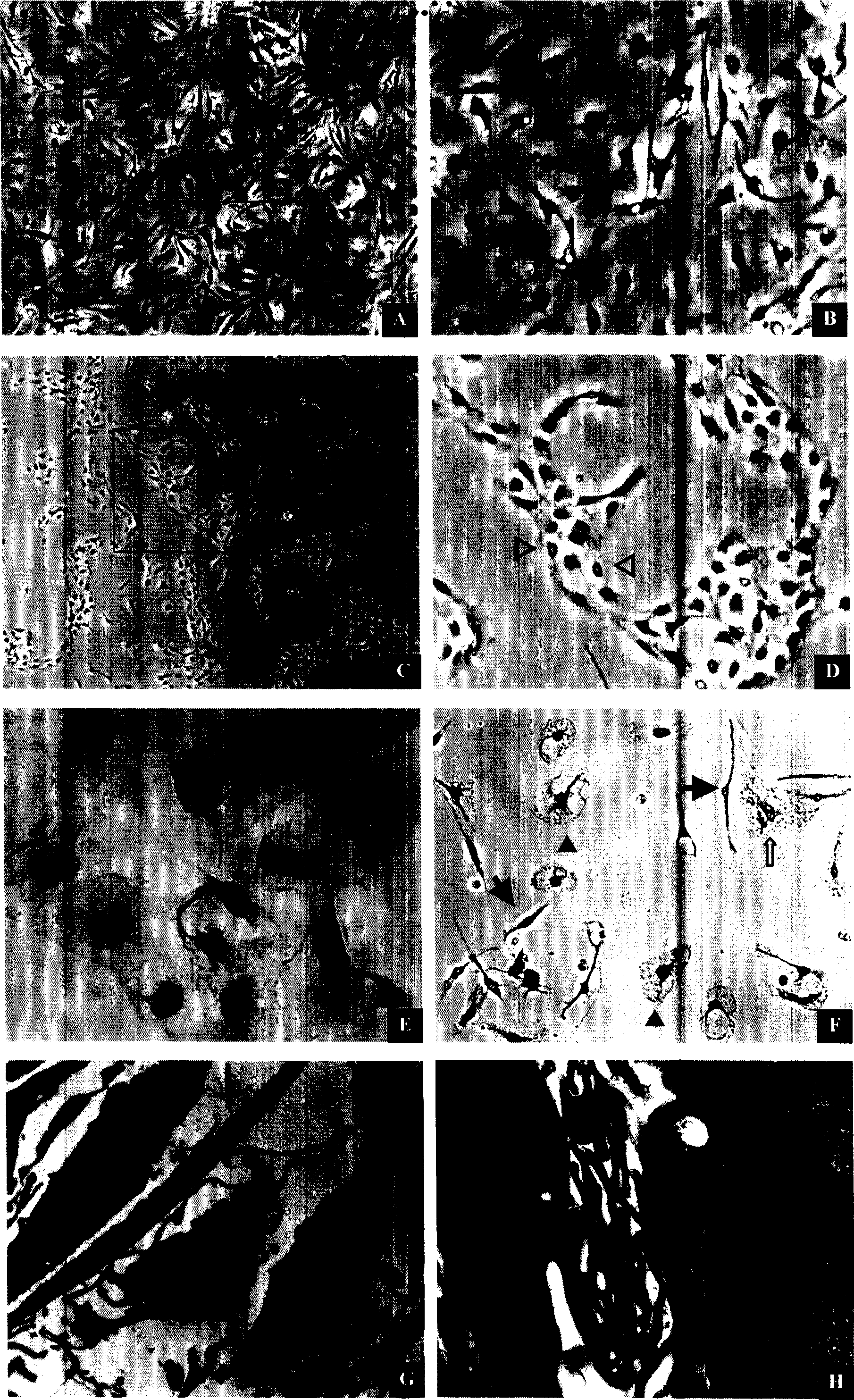 Separation method for Leydig cell and use thereof