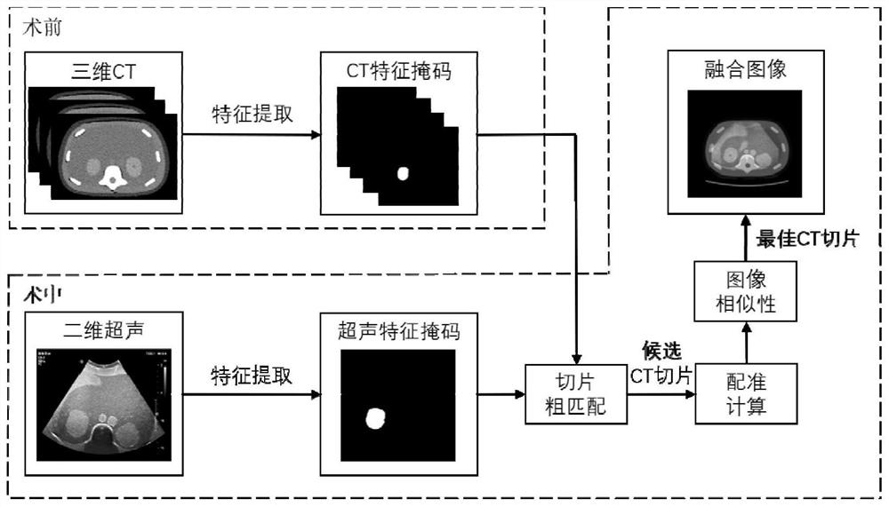 Ultrasonic image and CT image registration method, device and equipment