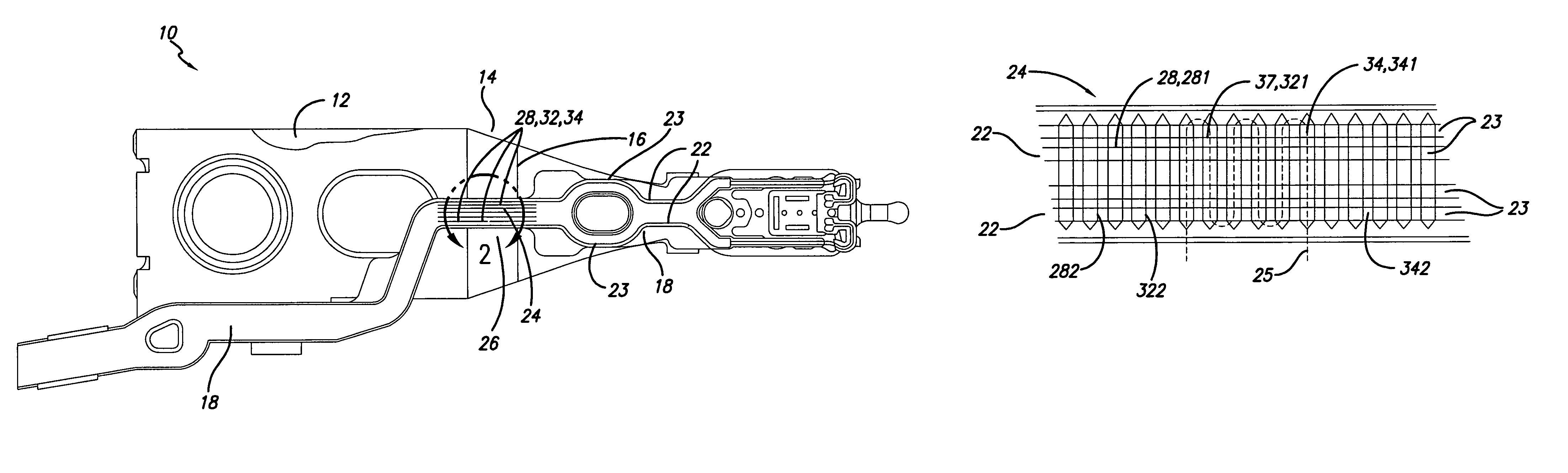 Impedance control with reduced stiffness contribution from electrical interconnect