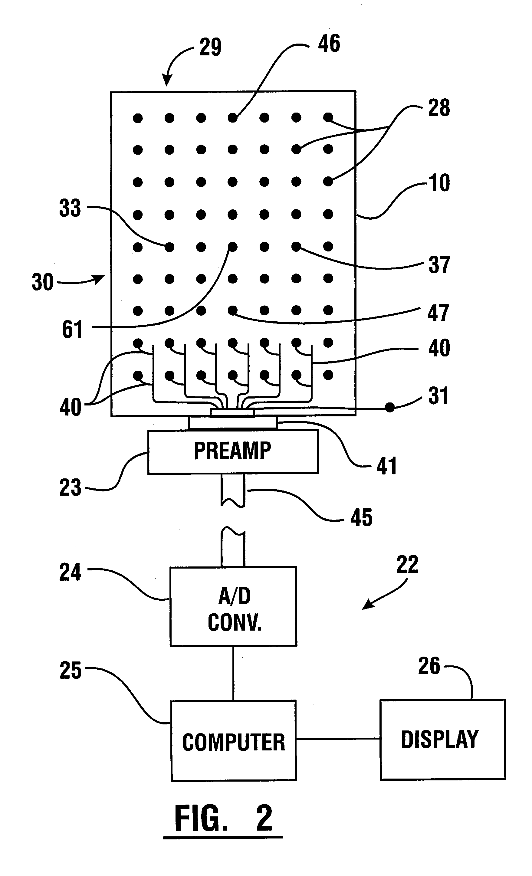 EMG Diagnostic System and Method