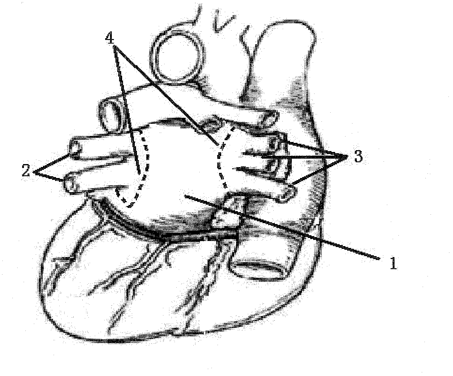 Chemical ablation device used for curing atrial fibrillation