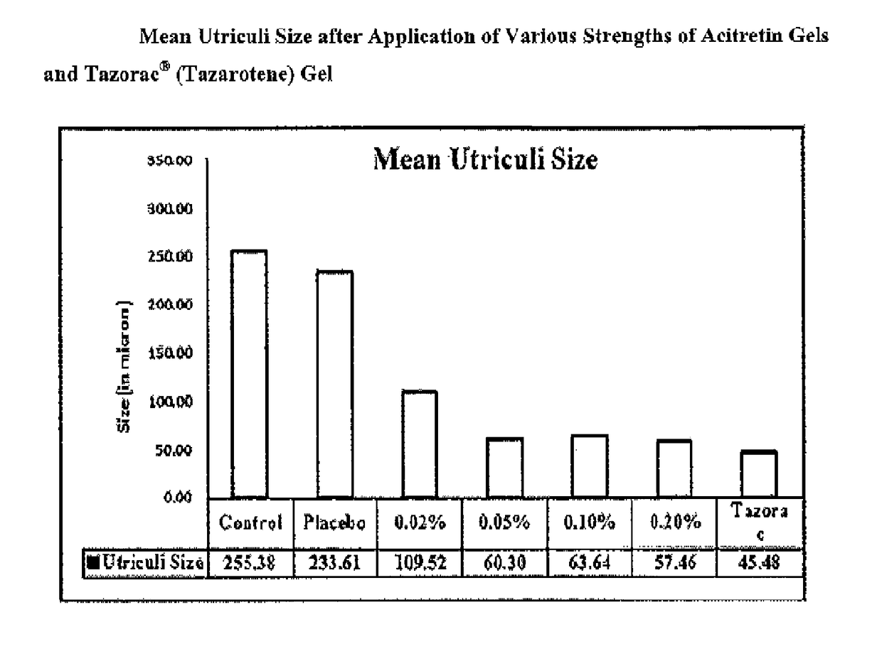 Topical pharmaceutical composition of acitretin