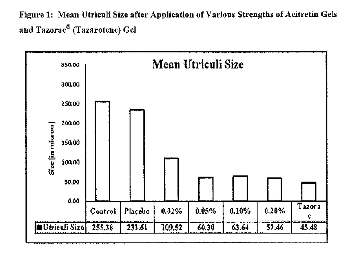 Topical pharmaceutical composition of acitretin