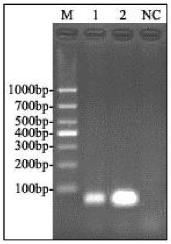 Fluorescent quantitative PCR method for detecting vibrio parahaemolyticus causing acute hepatic pancreatic necrosis