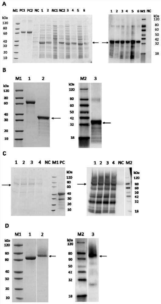 Peach fruit acid invertase inhibitor gene ppinh1, encoded protein and its cloning method and application