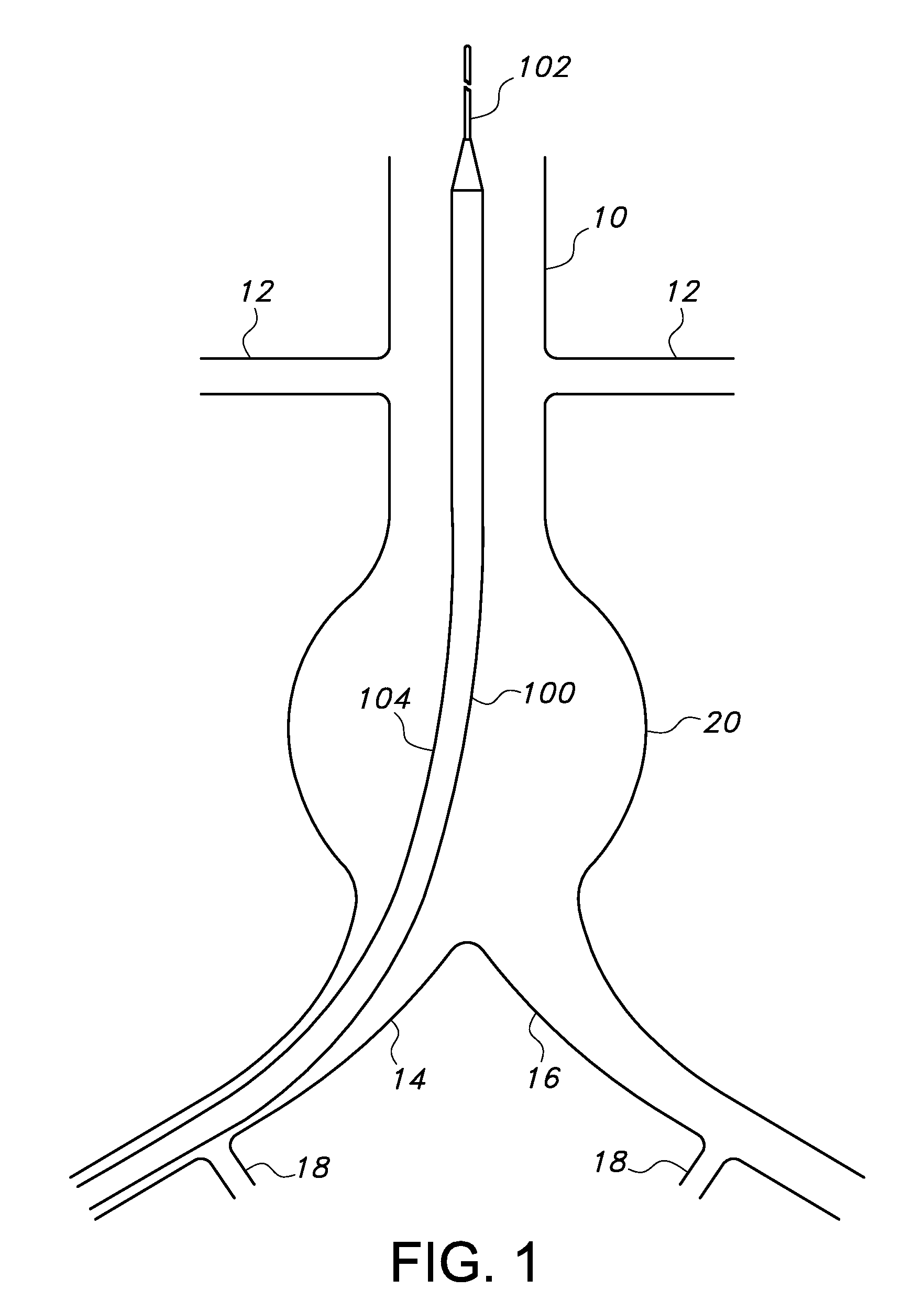 Bifurcated endovascular prosthesis having tethered contralateral leg