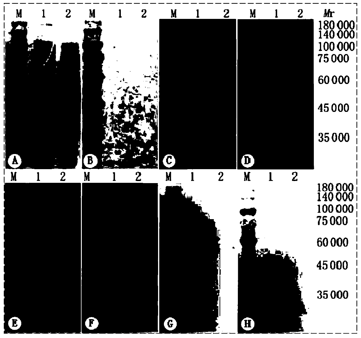 Recombinant antigen protein for detecting dengue 2 type virus antibody, kit and application of recombinant antigen protein