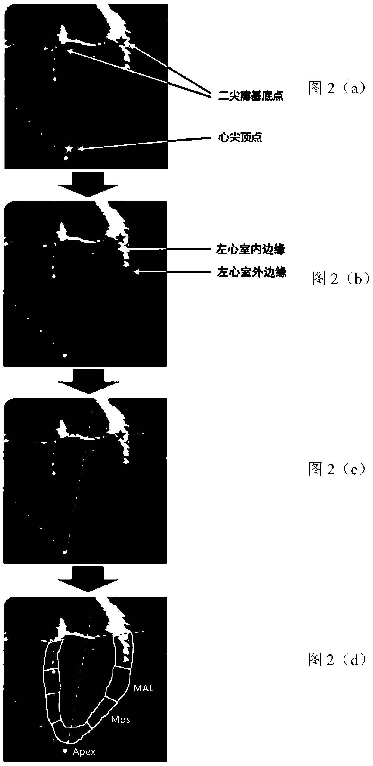 Cardiac medical image processing method, processing device, processing system and medium