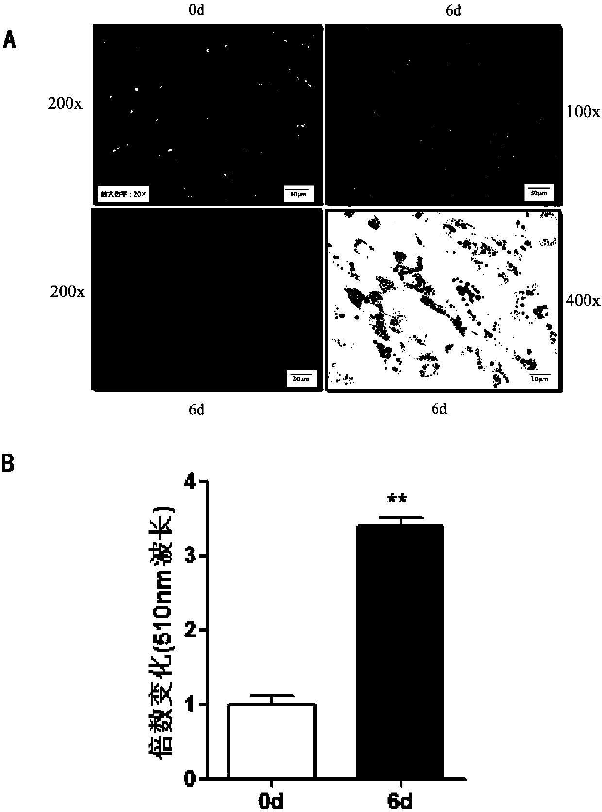 Separation, culture and induction differentiation method for precursor adipocyte in chicken muscle