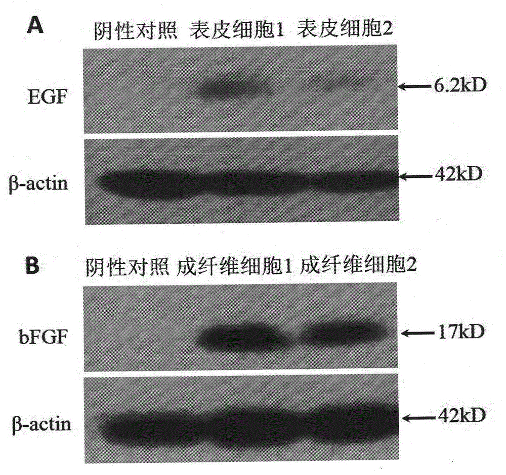 Method for simultaneously preparing autologous epidermal cells and fibroblasts, and biological beauty product comprising autologous epidermal cells and fibroblasts