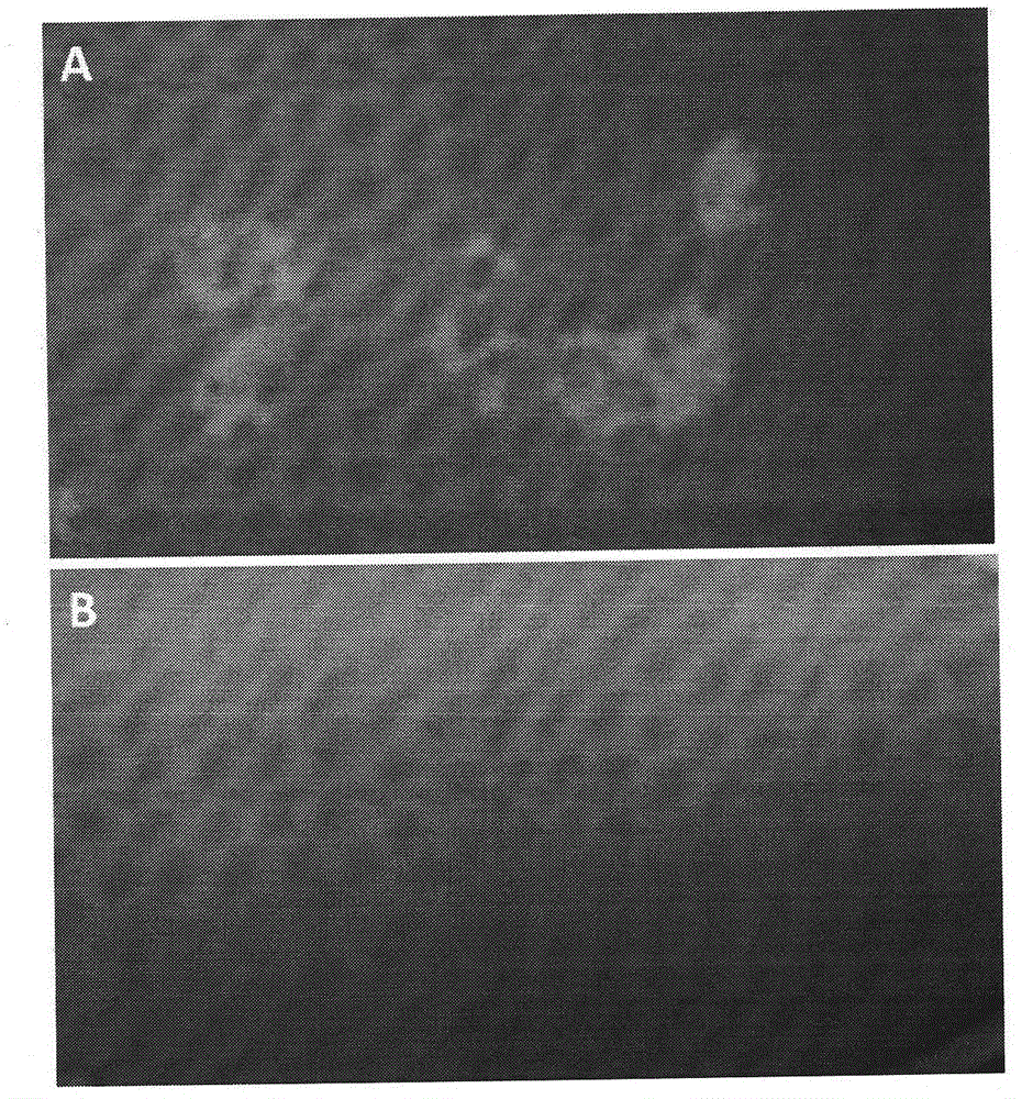 Method for simultaneously preparing autologous epidermal cells and fibroblasts, and biological beauty product comprising autologous epidermal cells and fibroblasts