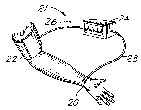 Portable blood pressure measurement device and blood pressure measurement method
