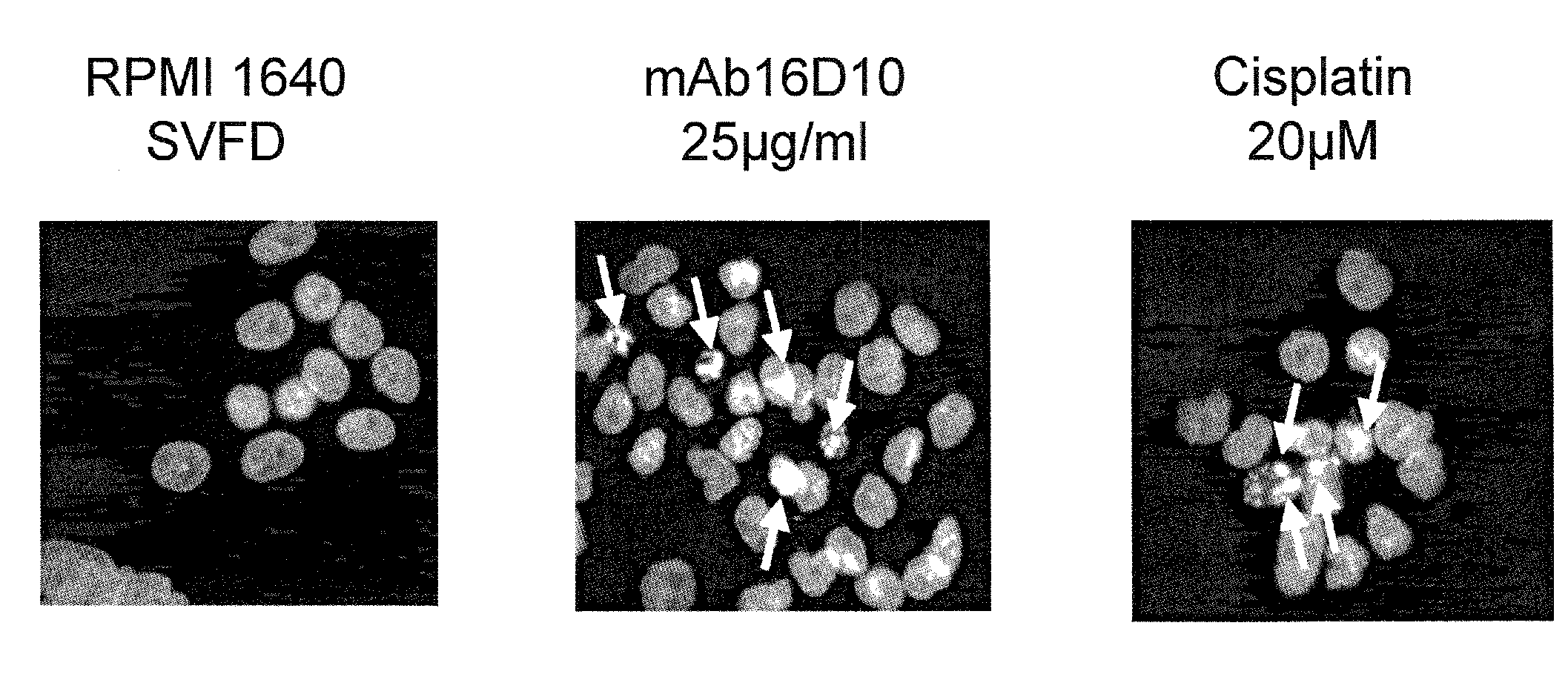 Compositions and Methods for Treating Pancreatic Tumors