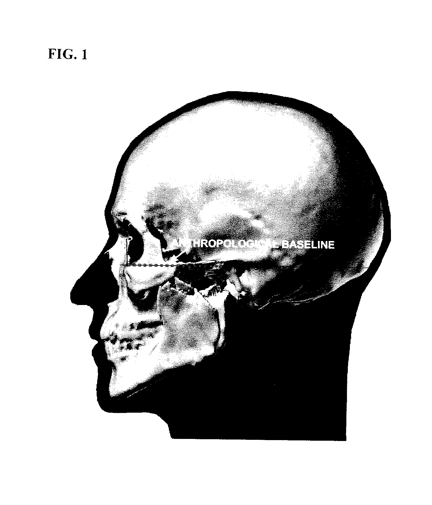 Method and apparatus for unambiguously determining orientation of a human head in 3D geometric modeling