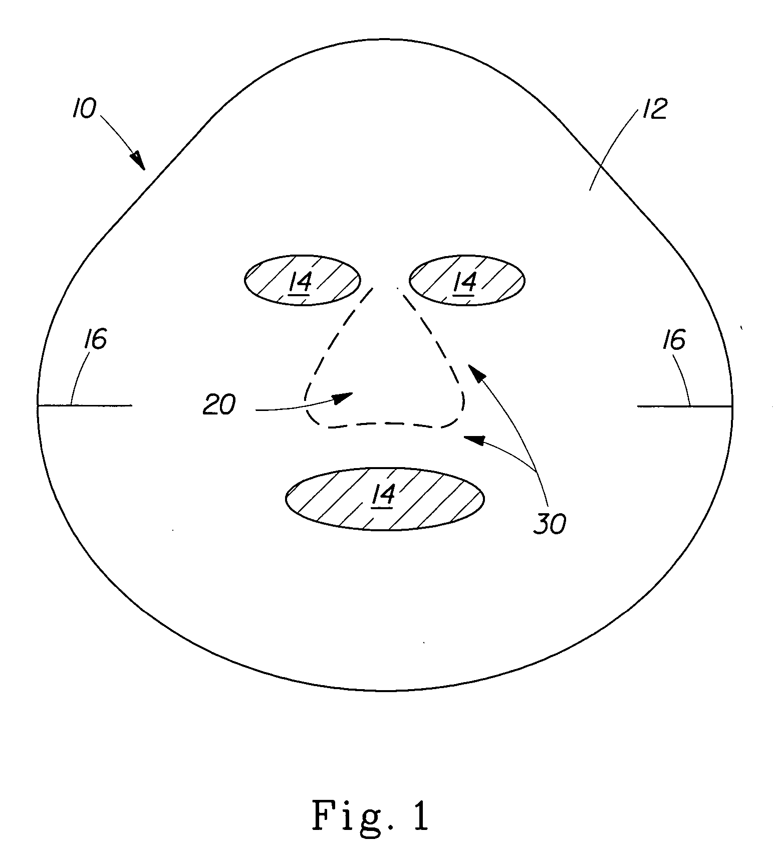 Treatment articles capable of conforming to an underlying shape