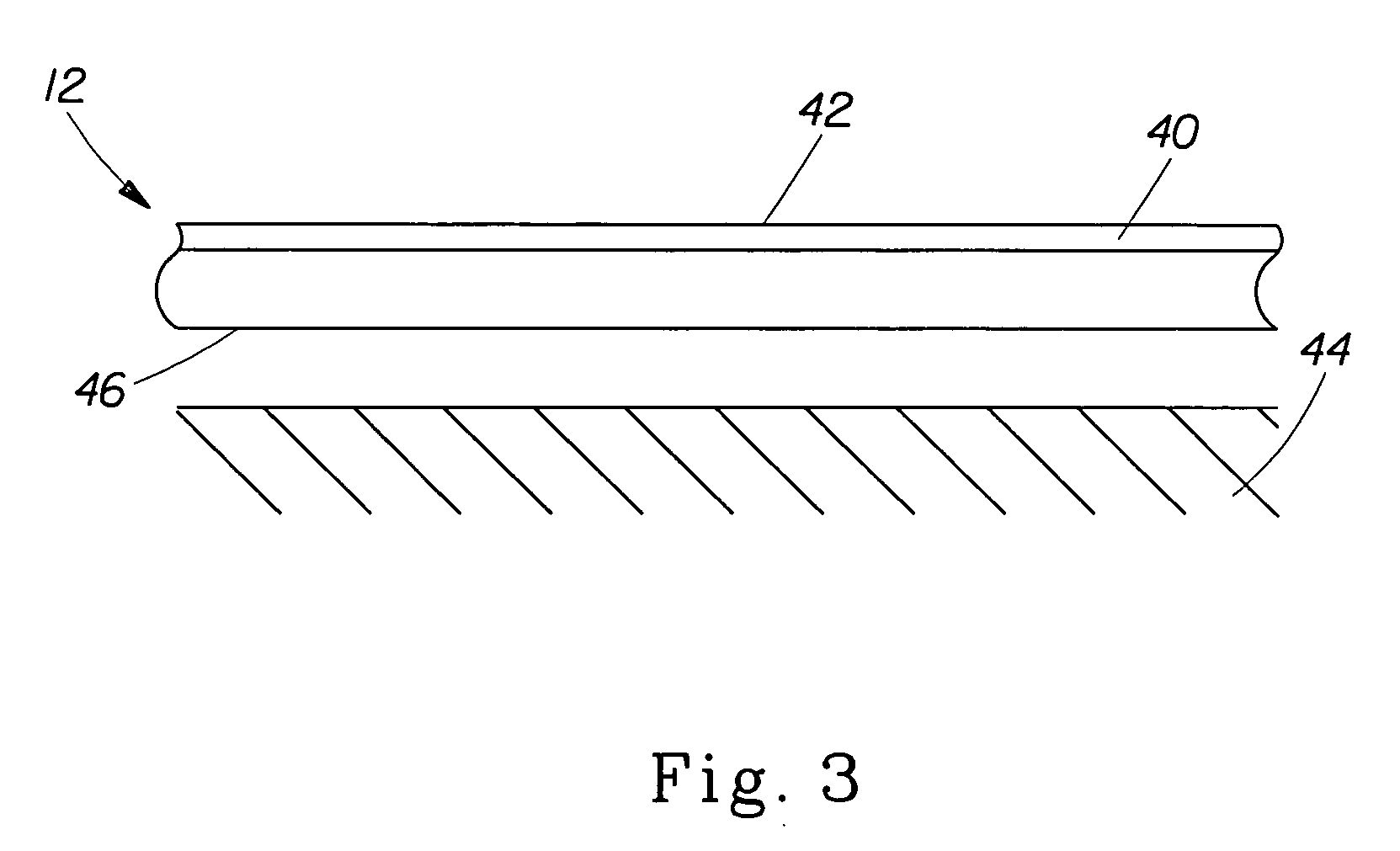 Treatment articles capable of conforming to an underlying shape
