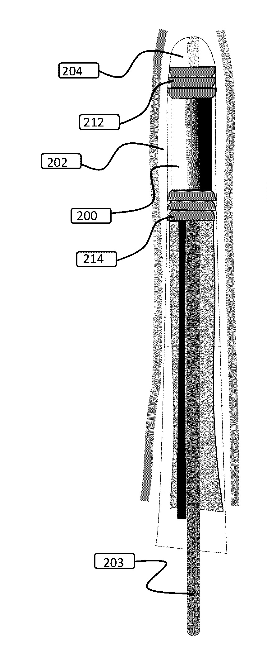 Devices and methods for anchoring a sheath in a tissue cavity