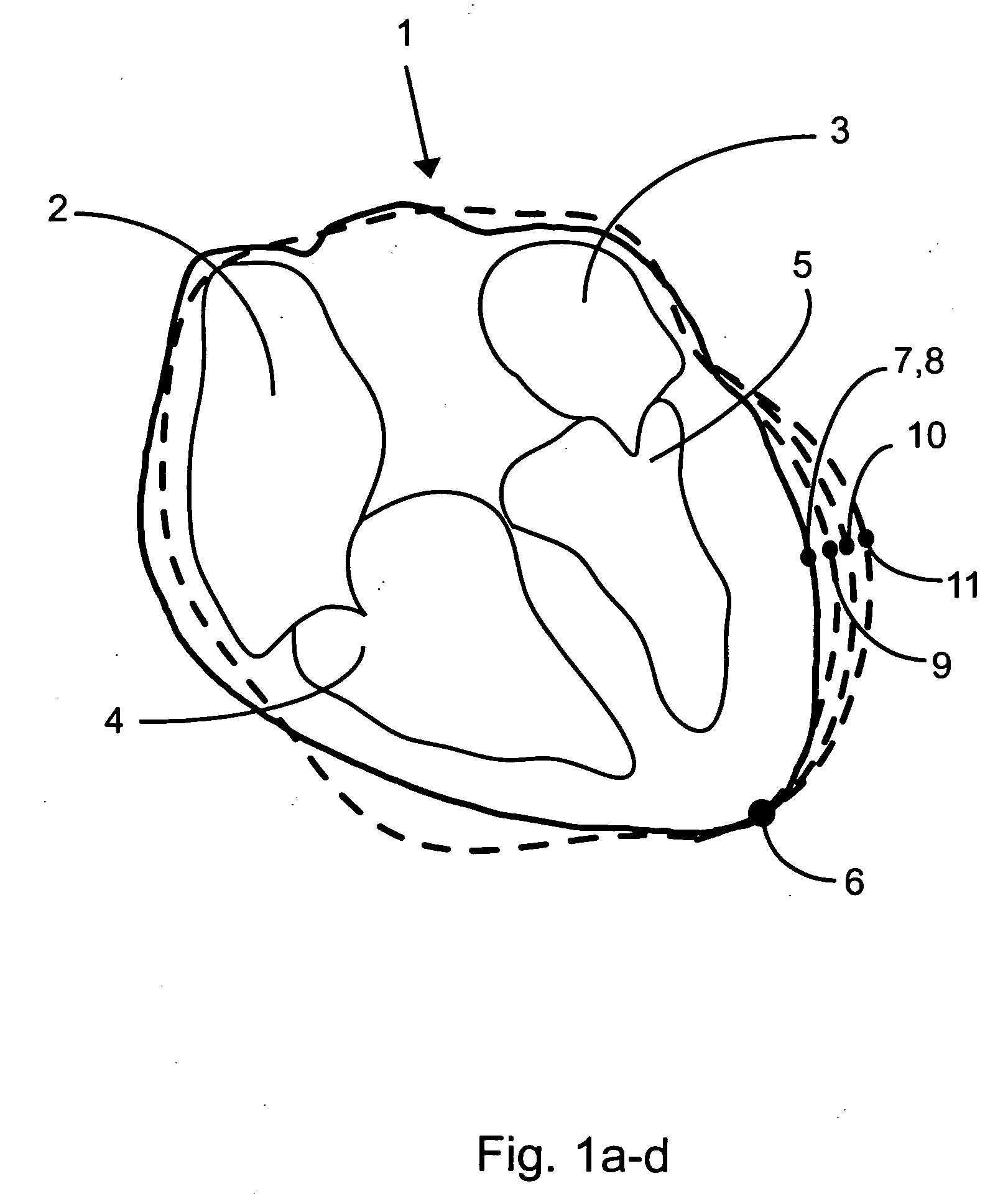 Method and system for measuring in a dynamic sequence of medical images
