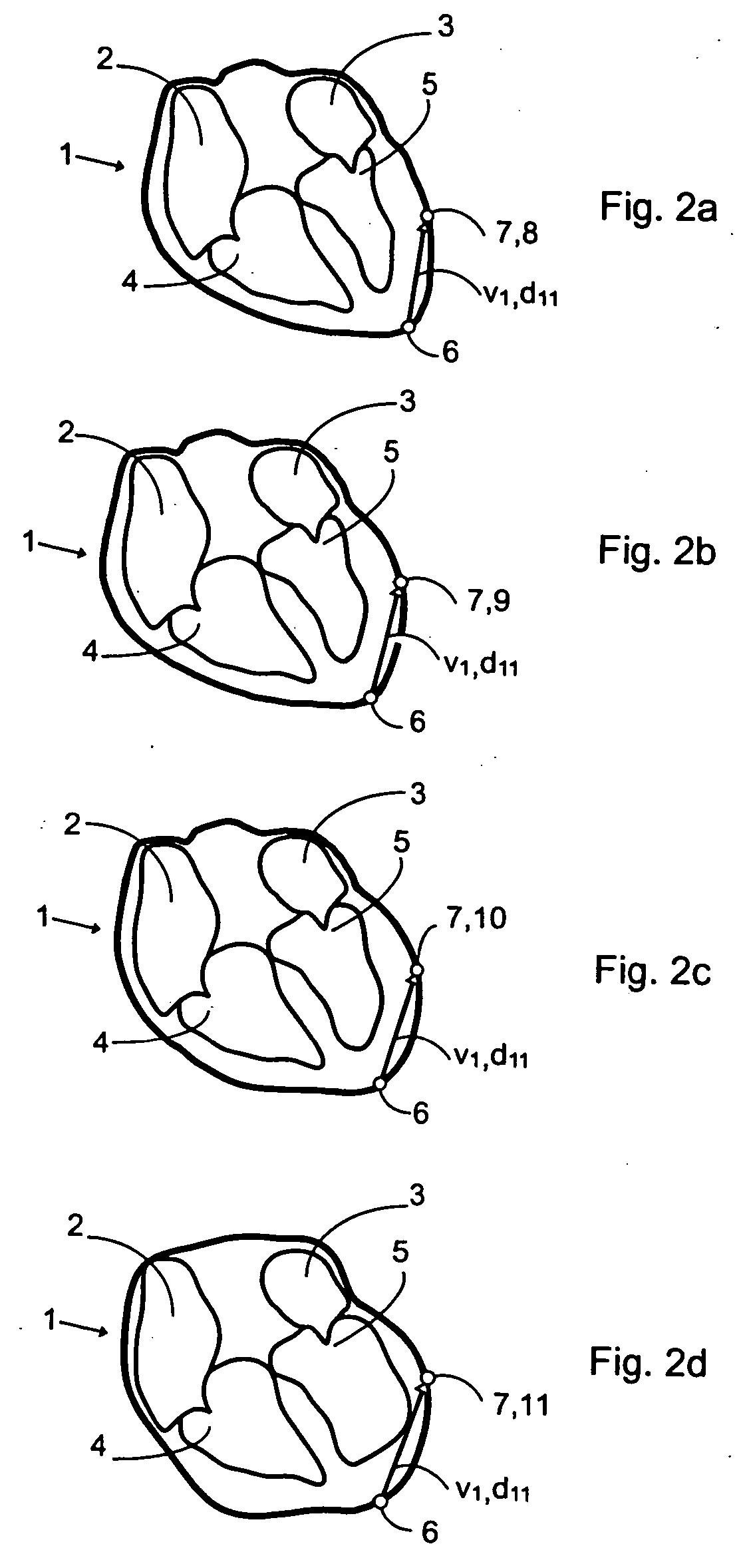 Method and system for measuring in a dynamic sequence of medical images