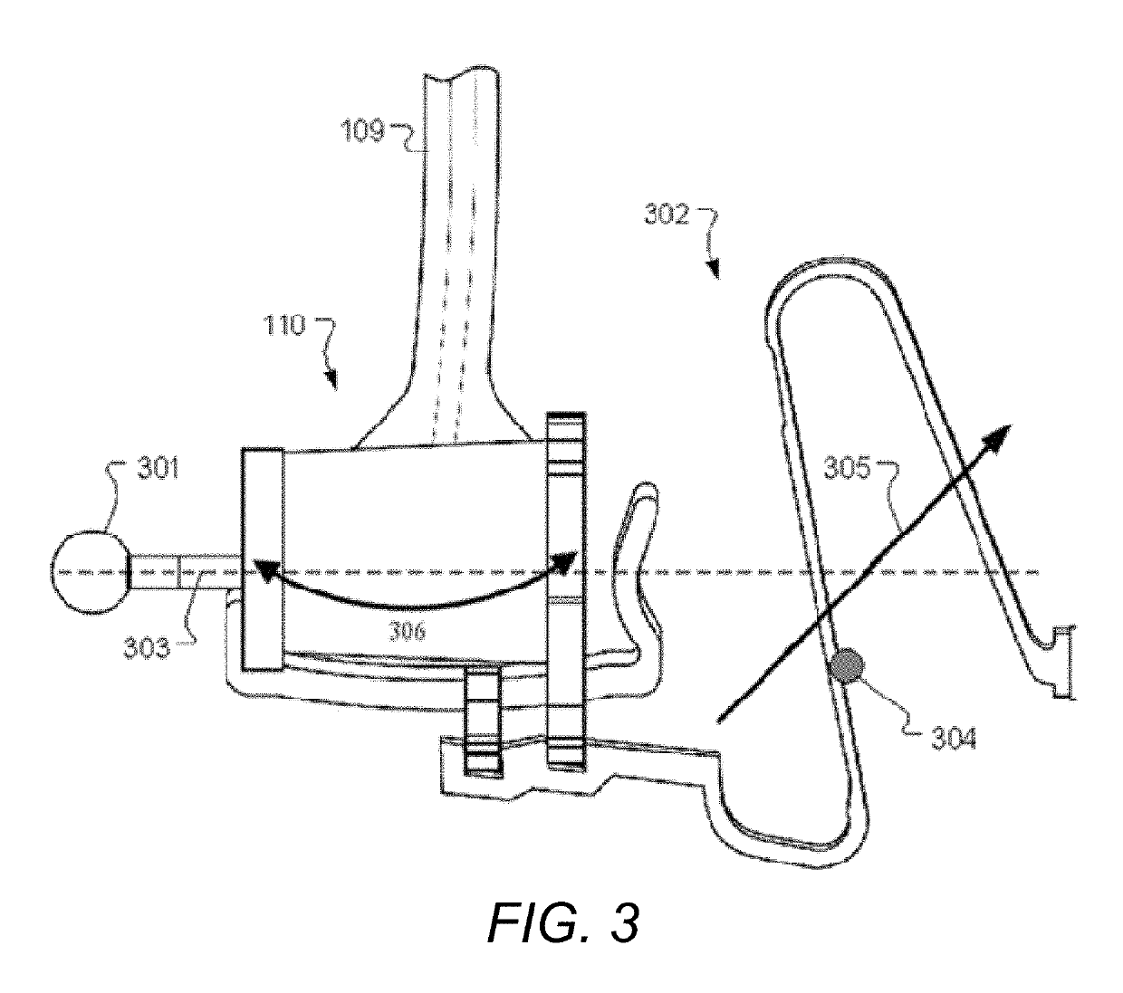 S-shaped coupling spring for middle ear implants